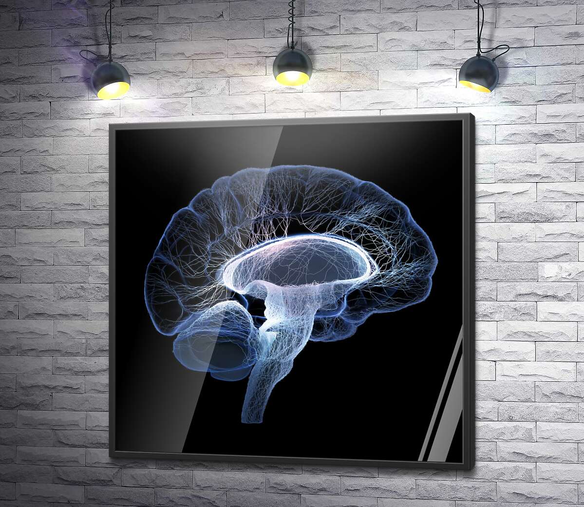 постер Нервная система мозга